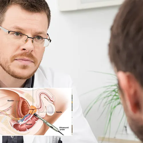 Understanding the Penile Implant Journey