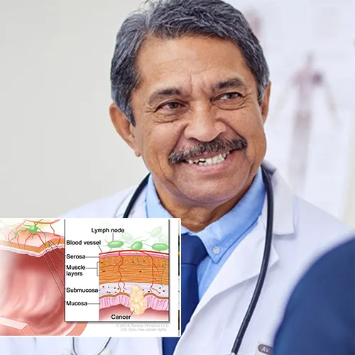 Educating Patients on Penile Implant Maintenance